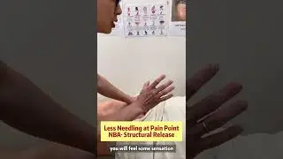 NBA &middot; Less Needling at Pain Points, Distal Points and Structural Release