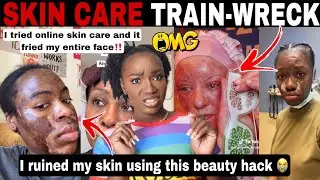 MERCY!😱 SKIN CARE GONE WRONG! MUST WATCH SKIN CARE DISASTERS | BEAUTY HACKS GONE WRONG | TIKTOK COMP
