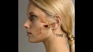 McMinnville Oregon TMJ / TMD Doctor Helps Patients Get Relief