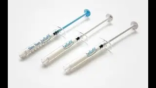 Bellafill for fat pad atrophy and heel pad atrophy