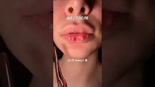 Маска на вб: #WW295503 (копируй)🔥 За 15 мин ВААУ результат на губах😍 #сухиегубы #пухлыегубы РП