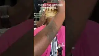 Traumatic HAIRLOSS client it’s been 30 years since she wore her real hair.