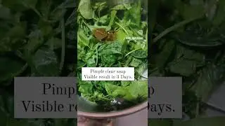pimple clear Soap #acne #beauty #natural #pimplefreeskin