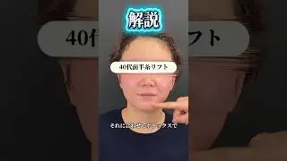 40代前半の糸リフト・ヒアルロン酸・ショートスレッド・ボトックスのモニター様です🌼
