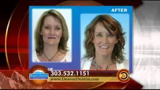 Barotz Dental - Colorado and Company (July 2013)