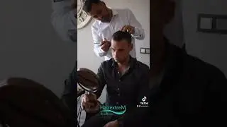 #haartransplantation #beardtransplant #greffedecheveux #greffedecheveuxistanbul #haartransplant #dhi