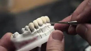 MIMIK: Zubn&aacute; technika