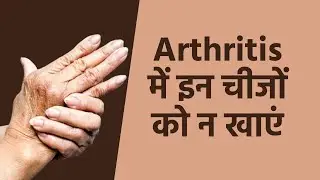 Diet Tips for Arthritis Patients: If you are suffering from arthritis pain, then eating these thi...