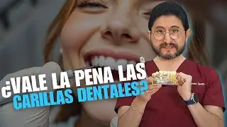 Dental Veneers: Everything You Need to Know for a Perfect Smile