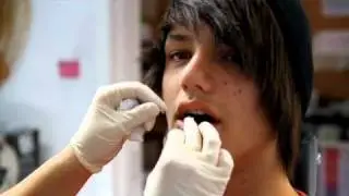 Snake Bites (piercings)