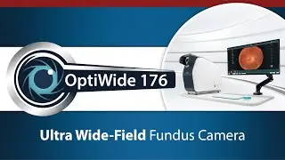 OptiWide 176 | The World&rsquo;s Widest Single-Shot True Colour Fundus Camera