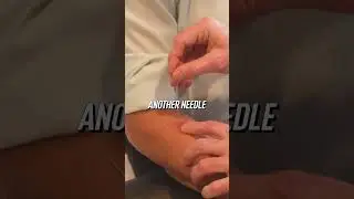 Acupuncture Explained!