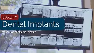 Quality Dental Implants | Spring, TX | Spring Creek Dentistry
