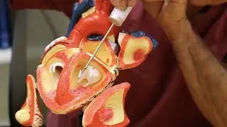 Dr. Oz explains how the device Mitralclip works