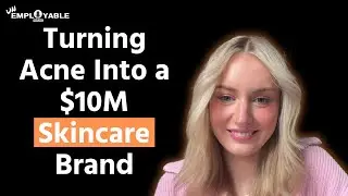Как Рэйчел Уайлд из TBH Skincare превратила борьбу с акне в бренд по уходу за кожей стоимостью 10 миллионов долларов