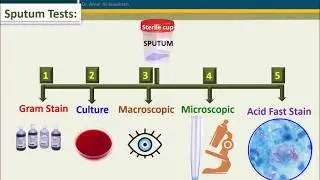 Sputum culture-When to reject sample?