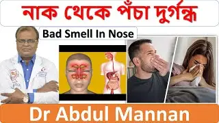 নাক থেকে পঁচা দুর্গন্ধ। Bad Smell In Nose | Best Homoeopathic Doctor In Bangladesh | Dr Abdul Mannan