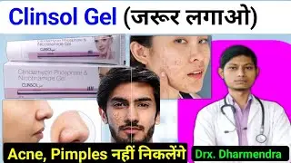 Clinsol gel review in hindi | Clinsol gel how to use | Clinsol gel review |Clinsol gel uses in hindi