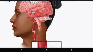 Term, CNs, part 2 || Dr. Obada Alayed