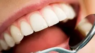 Teeth Whitening by Dr. Carol Ford, Phoenix Cosmetic Dentist