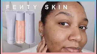 FENTY SKIN! | HONEST First Impressions Review | Oily + Acne-Prone Skin