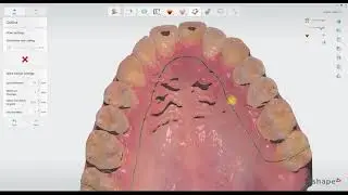 Tutorial sul nuovo 3Shape SplintStudio