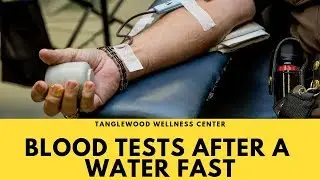 doing blood tests after a WATER FAST
