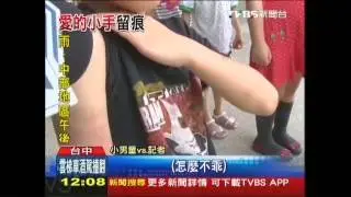 誇張！幼稚園功課沒寫　童被打到瘀青
