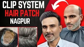 Australian Miraj Hair Patch In Nagpur | Clipping Hair Patch In Nagpur | Clipping Hair Patch review