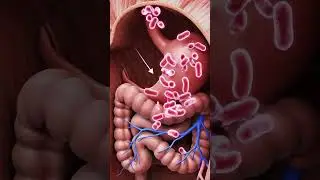Dog Having Stomach Pain After Eating Something Wrong | Pet Health Awareness