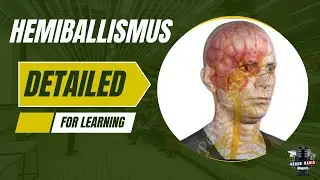 What is Hemiballismus? | Simple Explanation for Physiotherapy Students