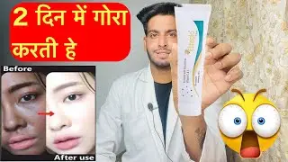 Eliteglo glutathione fairness cream review | Elite glow cream review | Eliteglo cream | eliteglo use