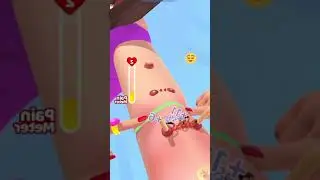 Acne Runner - All Levels Gameplay Android,ios