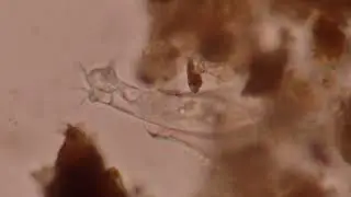 Ciliate with a vase-like lorica 
