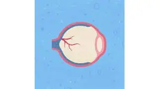 How Ang-2 Breaks Down Retinal Blood Vessels