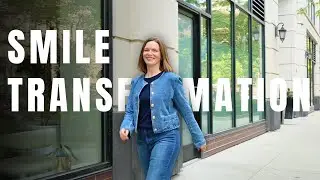 Chicago Dental Studio | Carrie's Confidence-Boosting Smile Makeover