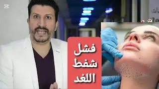 فشل شفط اللغلوغ 💥 نحت اللغد💥 نحت الفكيين 💥 شد الرقبة ☢ إحزروا ما يخفيه دكاترة التجميل عنك 👍 #الرقبة