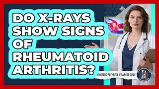 Do X-Rays Show Signs Of Rheumatoid Arthritis?