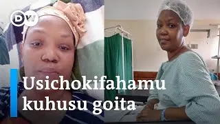 Fahamu ugonjwa wa goita na madhara yake