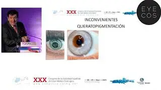 Canvi color d'ulls - Clinica Eyecos