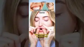 Gummy smile exercises | Gummy smile with Simple exercise | #shorts #gummysmile