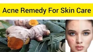 Acne Remedy For Skin Care | Skin Care For Acne | Acne Mask