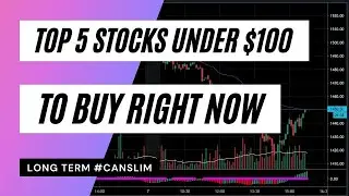 Top 5 long term stocks to buy right now under $100.
