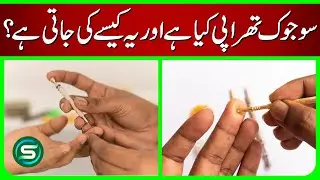 Sujok Therapy: Complete Guide & Step-by-Step Treatment