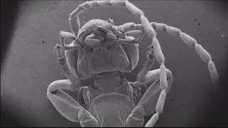 Beckman Insititute Bugscope