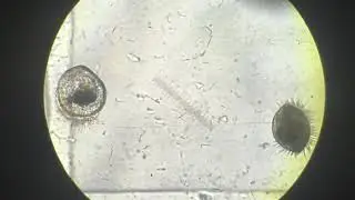 Ostrea angasi larvae