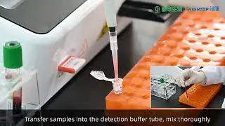 Hightop Fluorescence Immunoassay analyzer Model: HTY-100