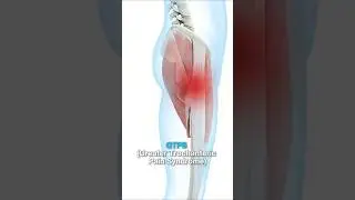 #1 Что такое GTPS (боковая боль в бедре)