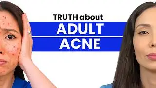 This Might Be Why You Still Have Acne (And It&rsquo;s Not What You Think)