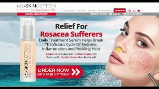 Skinception&reg; Rosacea Relief Serum Review and more